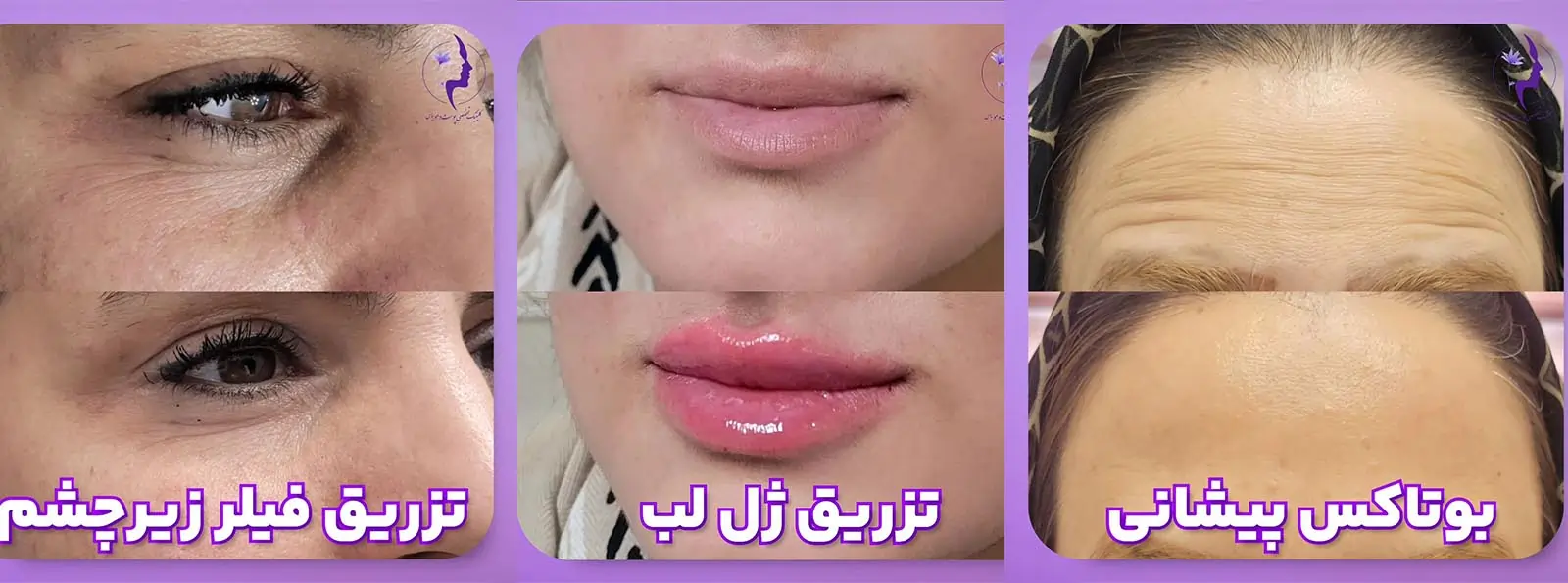 مرکز زیبایی یاس در مشهد