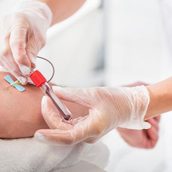 نمونه گیری در منزل مشهد